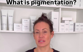 What is pigmentation